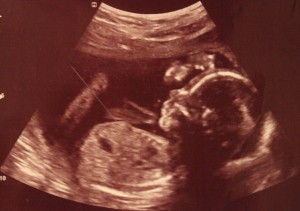 Baby Oliva Ultrasound